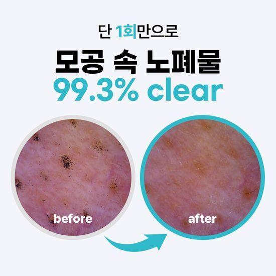Point and Deep Clean Whip Cleansing Foam 120g 1+1 Promotion