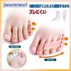 SUPORYA Pinky Toe for Ingrown Small Toe Corrective Spreads Interdigital Toe Protection Gel Easy to Put On and Take Prevents Beautiful For Home and