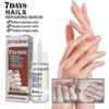 Jaysuing 7 Days Nail Repair Essence Element Repair Ingrown Nail Thickening Gray Nail Hand Foot Nail Repair Liquid