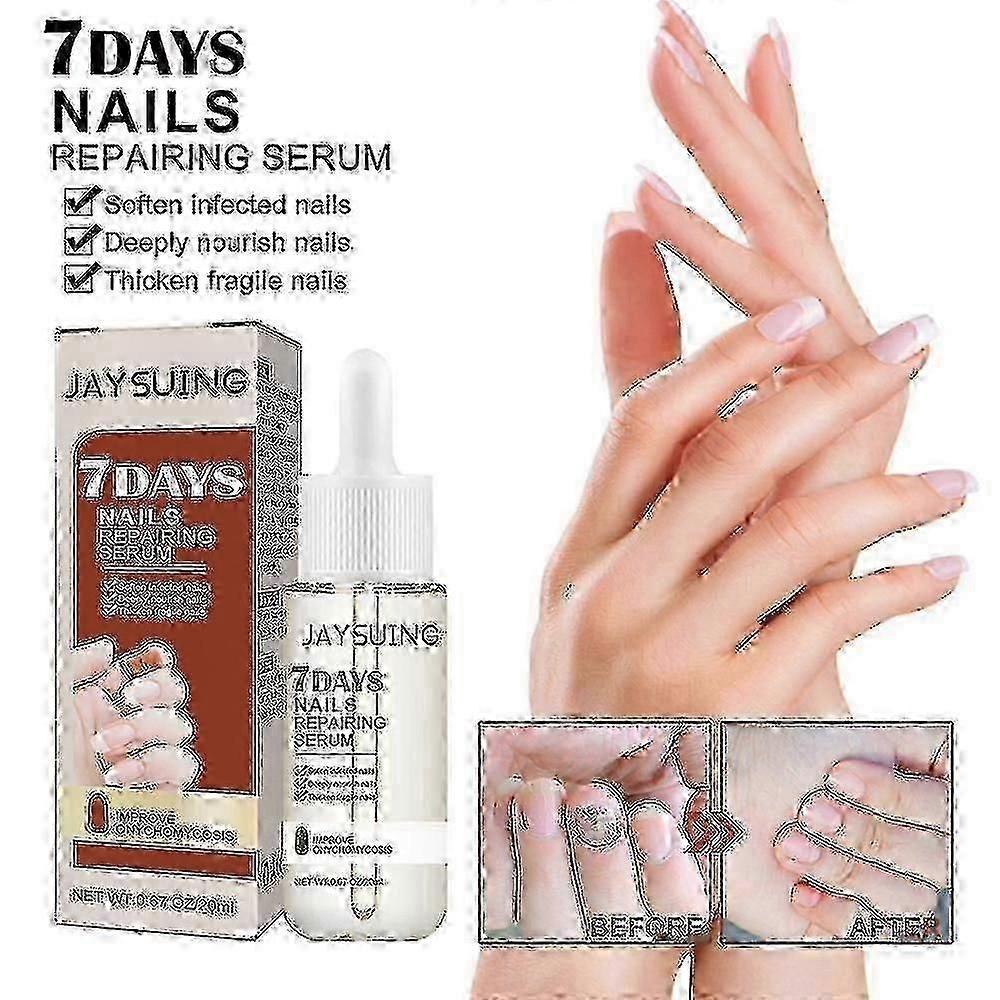 Jaysuing 7 Days Nail Repair Essence Element Repair Ingrown Nail Thickening Gray Nail Hand Foot Nail Repair Liquid