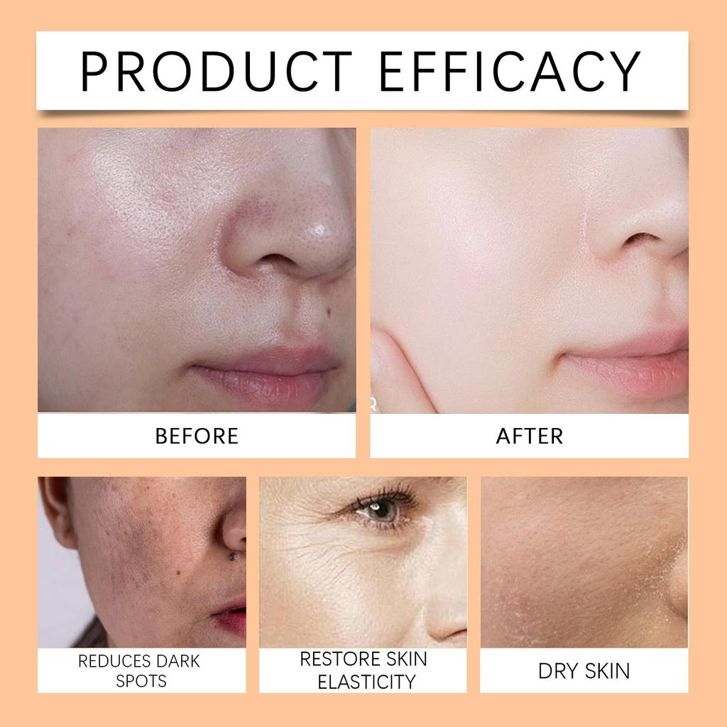 West&Month Papaya Facial Cream Fades Dark Spots Brightens Skin Hydrates & Moisturizes For Face Use 1 set