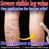 Herbal Varicose Veins Relief Ointment - Eases Discomfort Gentle Skin-Safe