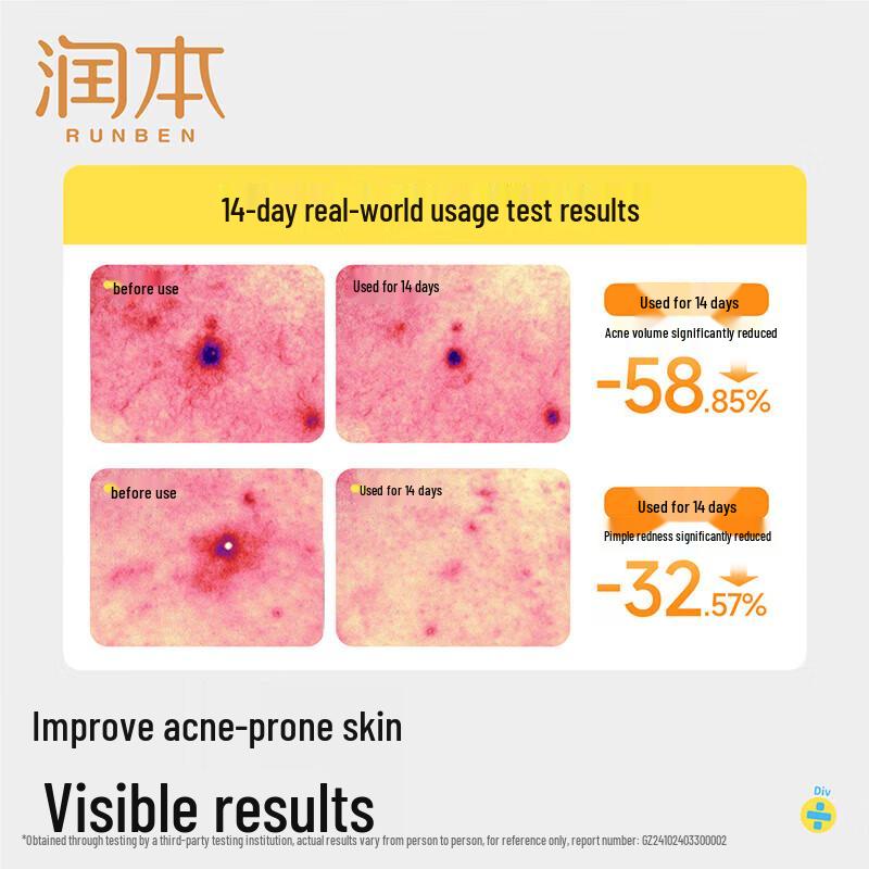 RUNBEN Teen Oil Control Acne Body Wash