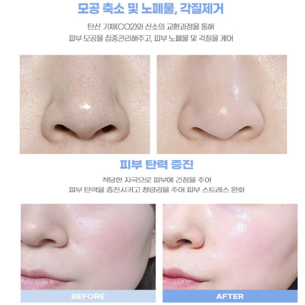 [ESTHETIC House] CO2 Esthetic Formula Carbonic Mask Pack (5ml*5ea)