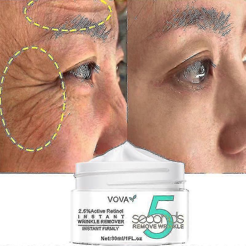 Retinol Wrinkle Removal Face Cream Firming Lift Anti-aging Eye Fade Fine Lines B