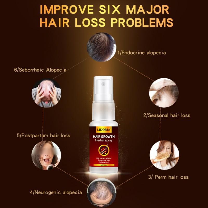 20ML Hair Growth Ginger Spray Oriental Oilss Hair Nutrition / Hair Loss Treatment Treatment Oil Hair Tonic Hair Care Loss