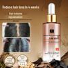 Zooly Anti-Hair Loss Scalp Serum