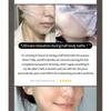 BARULAB - Steamsheet Moisture Shield Facial Mask Set