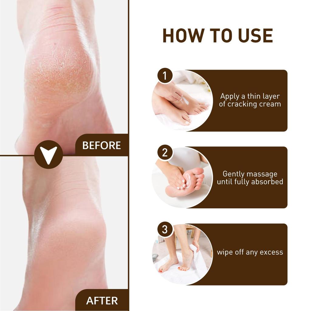 15g Cracked Heel Treatment Cream Repairing Feet Anti-Dry Cracked Peeling Chapped Moisturizing Foot Cream