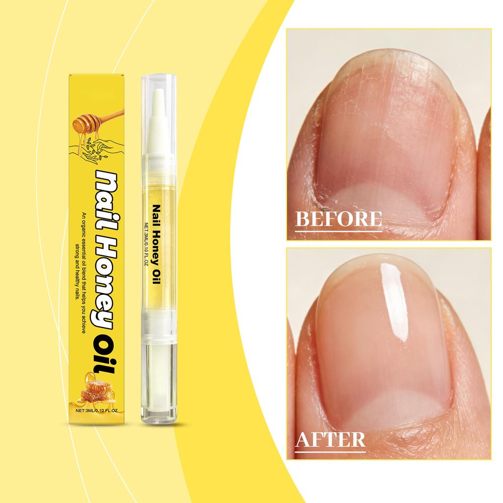 Nagelpflegeöl Stift: Tägliche Feuchtigkeitspflege und sanfte Pflege für glatte Nageloberflächen(3ml