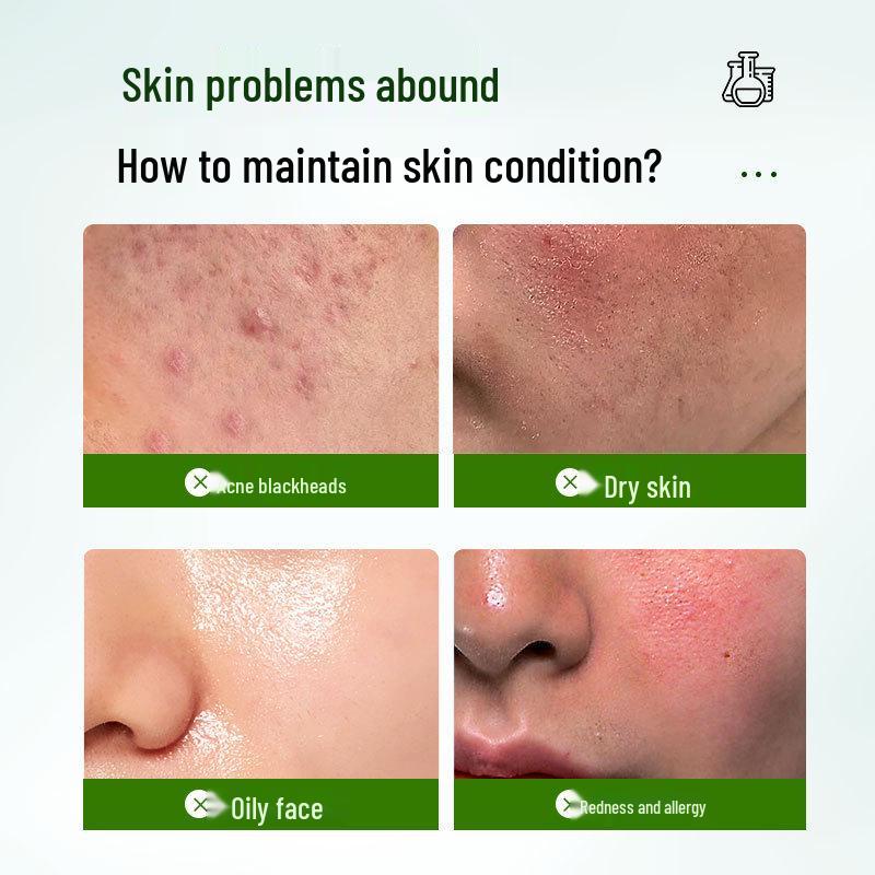 Onsen Anti-Acne Water Light Essence for Acne-Prone Skin - Oil Control & Comedone Treatment