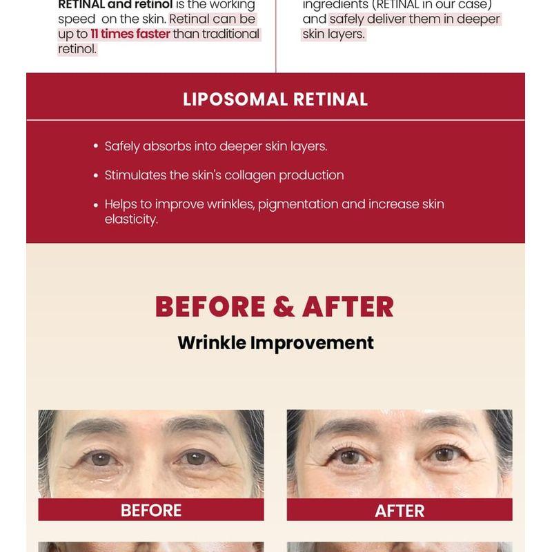 KSECRET SEOUL 1988 Cream : Retinal Liposome 1% + Fermented Rice