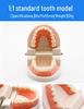 Dental Educational and Communication Model Set: Comprehensive, Removable, and Implant Restoration Models