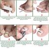 1Pcs Toenail Straightening Clip Ingrown Toenail Correction Tool Nail Treatment Elastic Patch Sticker Foot Care Pedicure