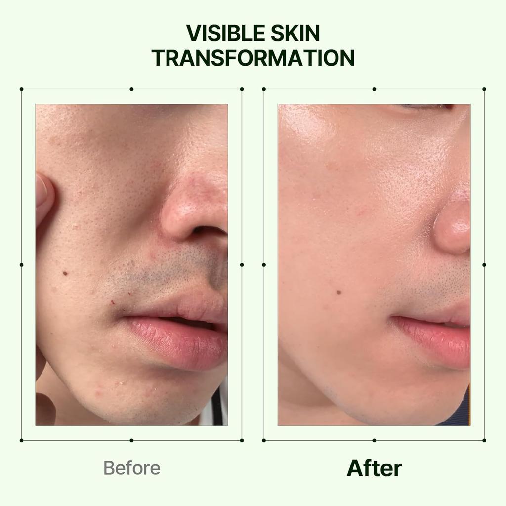 ORIEN Mugwort Collagen Pore Serum 30ml