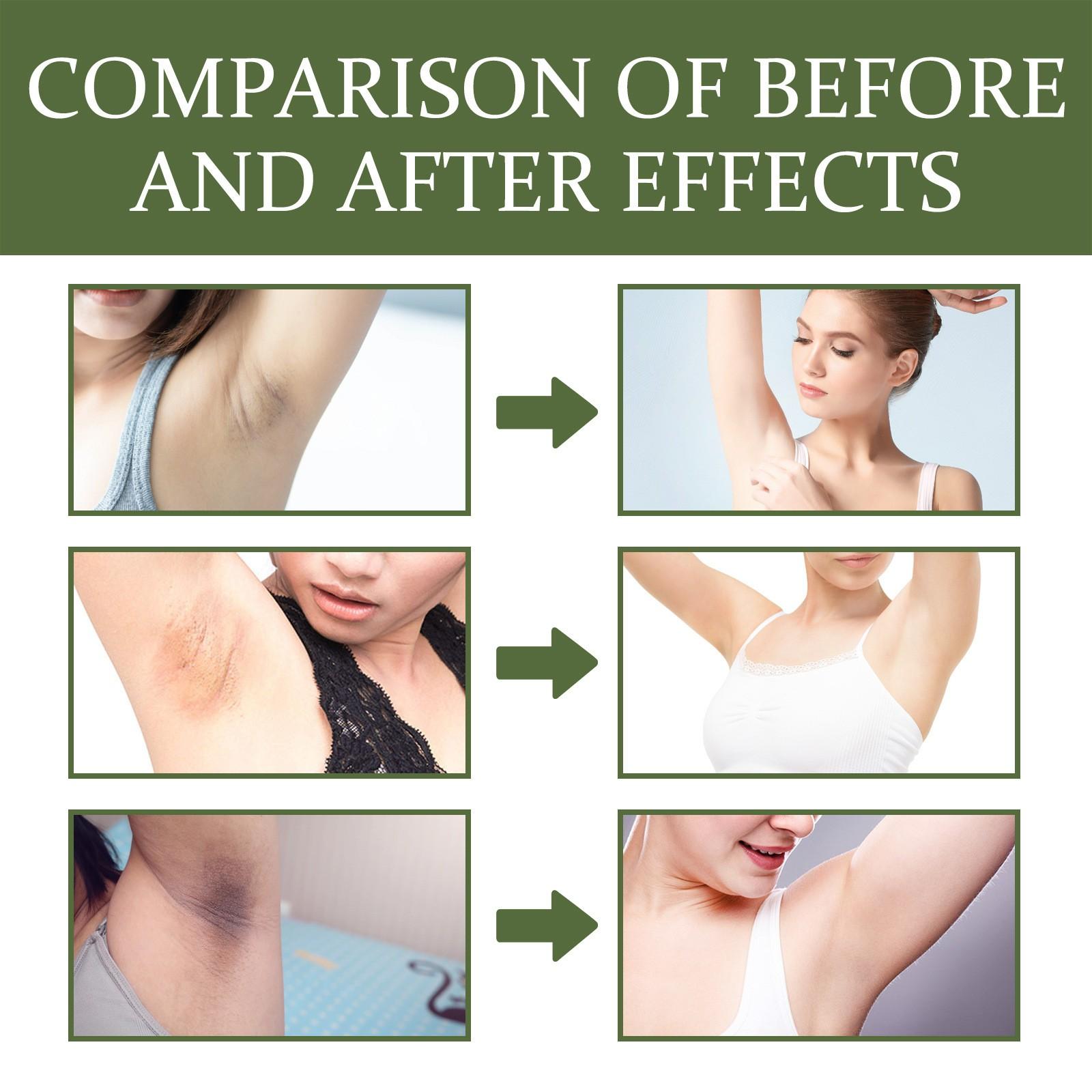 30 мл черная паста для удаления подмышек и бедер — фото 8