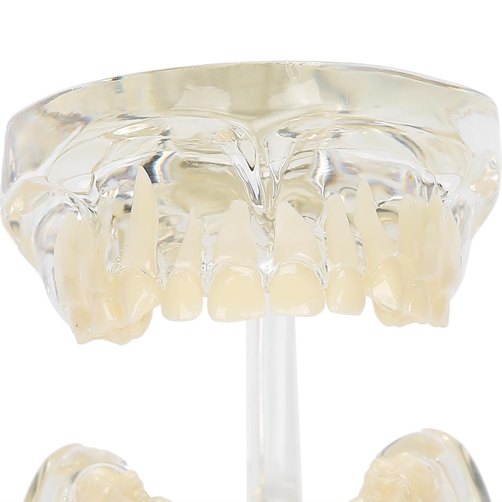 Dental Deciduous Teeth Model Removable Teeth Model Teaching Tool for Dentist