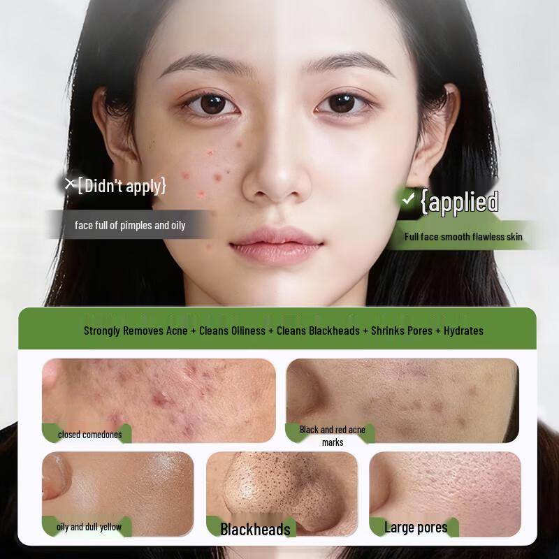 DR.CFUN Salicylic Acid Acne & Oil Control Sheet Mask