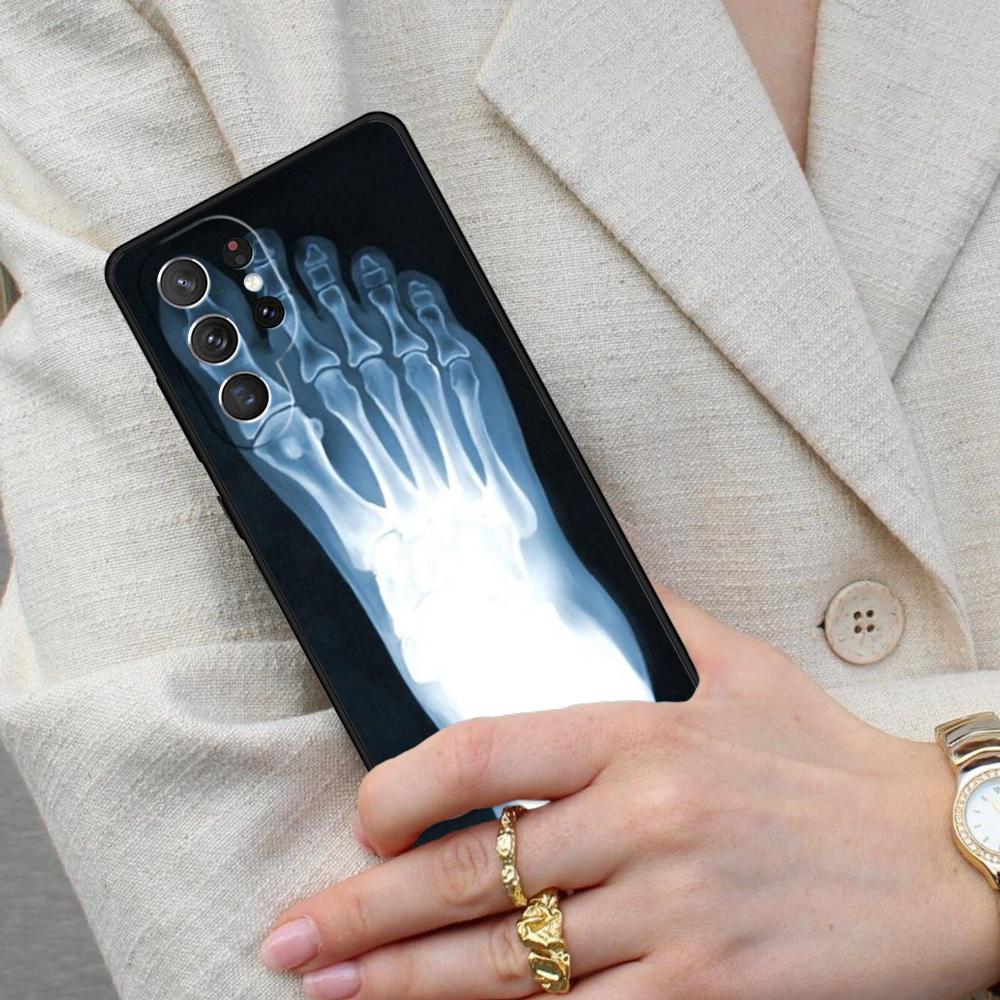 Skeleton X-Ray Cell Phone Case for Samsung Galaxy S26 Ultra S25 S24 S23 S22 S21 S20 Note10 Cover