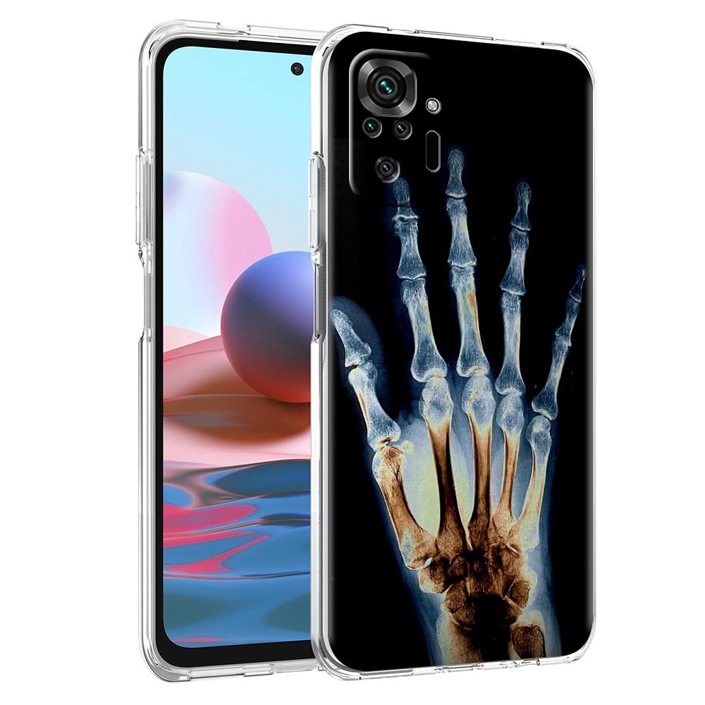 Transparent Phone Case for Redmi 14C 13C 10C 10 9 Note 13 12 11 K50 K40 Plus Pro 4G 5G Soft TPU Cover Autumu X Ray Hand Bones