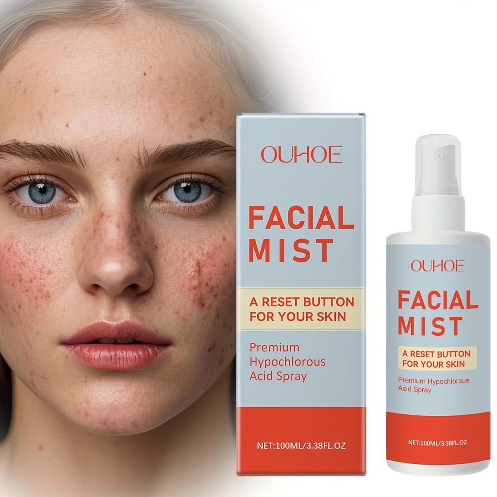 Hypochlorous Acid Facial Spray Reduce Redness Swelling Acne Pimple Repairing Soothing Oil Control Pore Refining Calm Skin Care