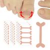 Nail Correction Stickers Ingrown Toenail Corrector Patches Paronychia Treatment Recover Corrector Pedicure Tools