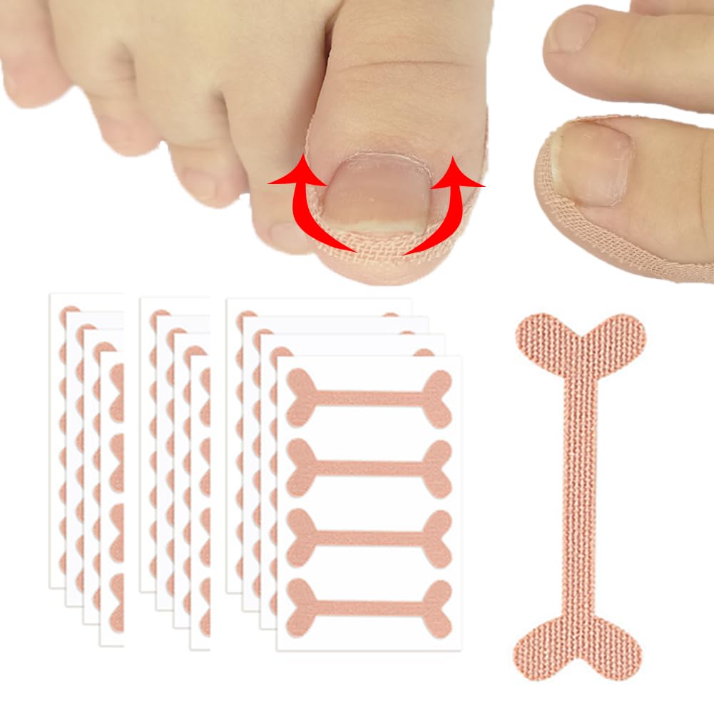 Nail Correction Stickers Ingrown Toenail Corrector Patches Paronychia Treatment Recover Corrector Pedicure Tools