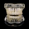 TOPGRILLZ Iced Out 10 Top &10 Bottom 5A CZ Stones Teeth Grillz Punk Rapper 14K Gold Plated Zircon Tooth Caps For Mouth Jewelry