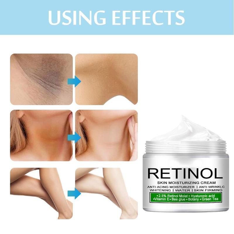 Beyazlatıcı Krem Beyazlatıcı Beyazlatıcı Yüz Vücut Aydınlatıcı Krem Koltukaltı Koltukaltı Beyazlatıcı Krem Bacaklar Dizler