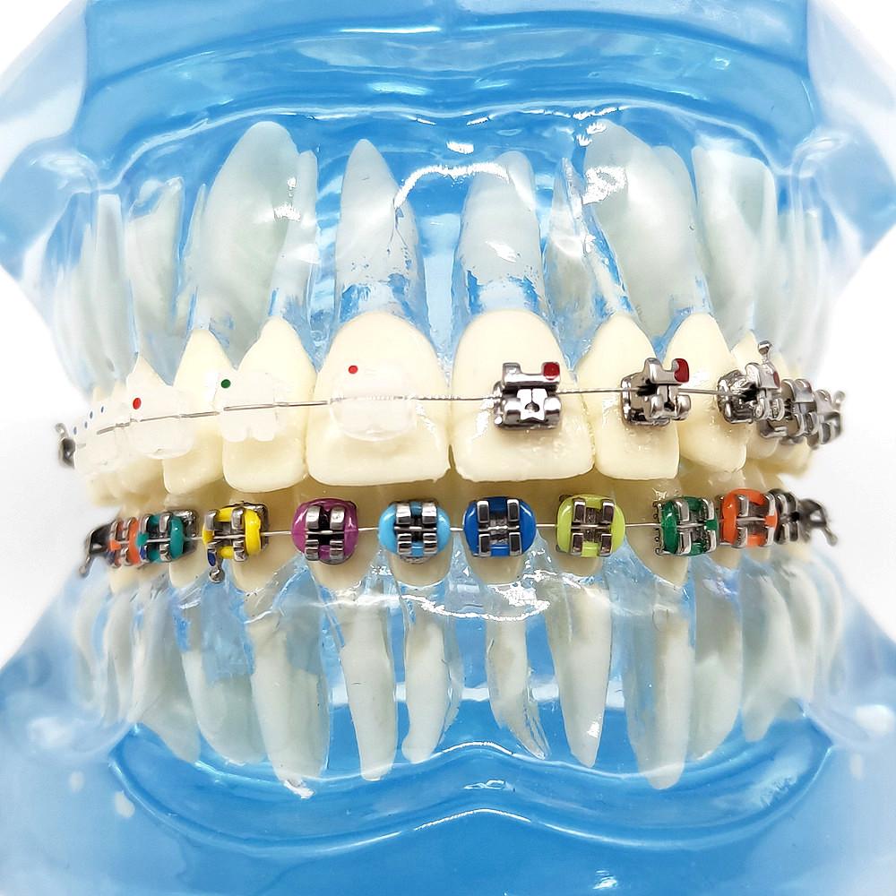 Dental Orthodontic Teeth Tooth Model 4 Kinds Brackets Ceramic and Metal Brackets for Patient Communication Dental Study Model