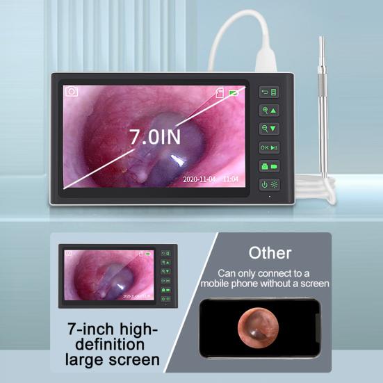 

1 комплект цифрового отоскопа 7-дюймовый экран высокой четкости 300 мА 3,9 мм ушная камера ушной серы инструмент для удаления ушной серы для дома