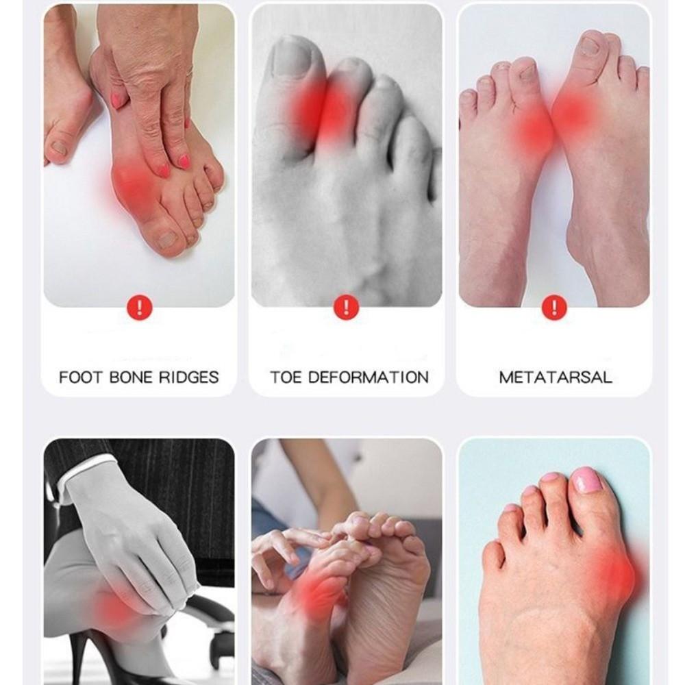 Micro-Current Toe Separator EMS Big Toe Straightener Correction Device Feet Valgus Correcto  Women