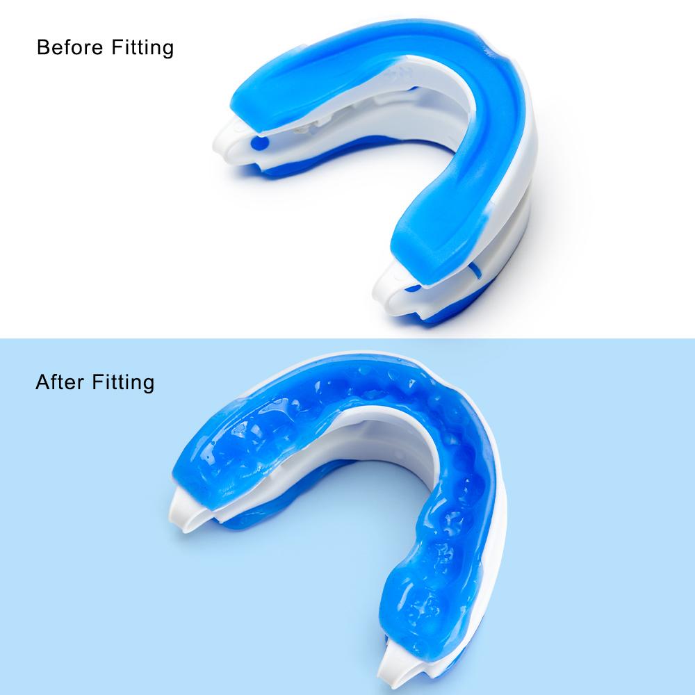 Adjustable Anti Snoring Mouth Guard Braces Anti-Snoring Mouthpiece Bruxism Snoring Stopper Improve Sleep Quality Better Breath