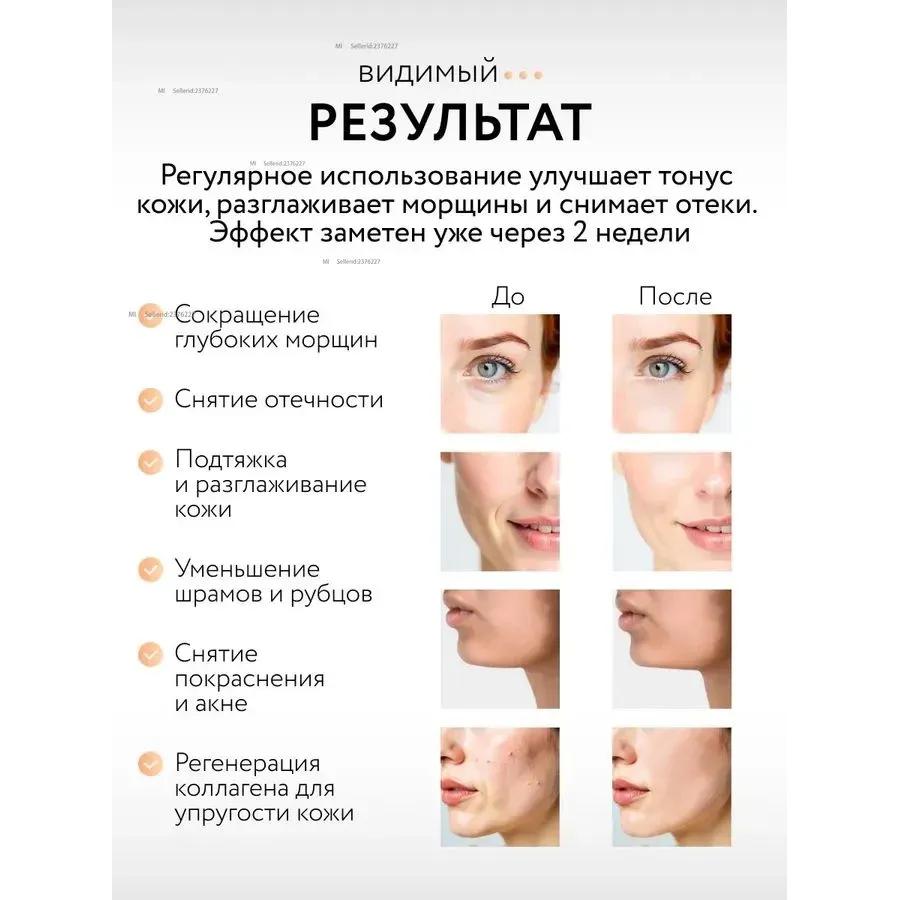 Micro facial massager, RF elevator, micro massager