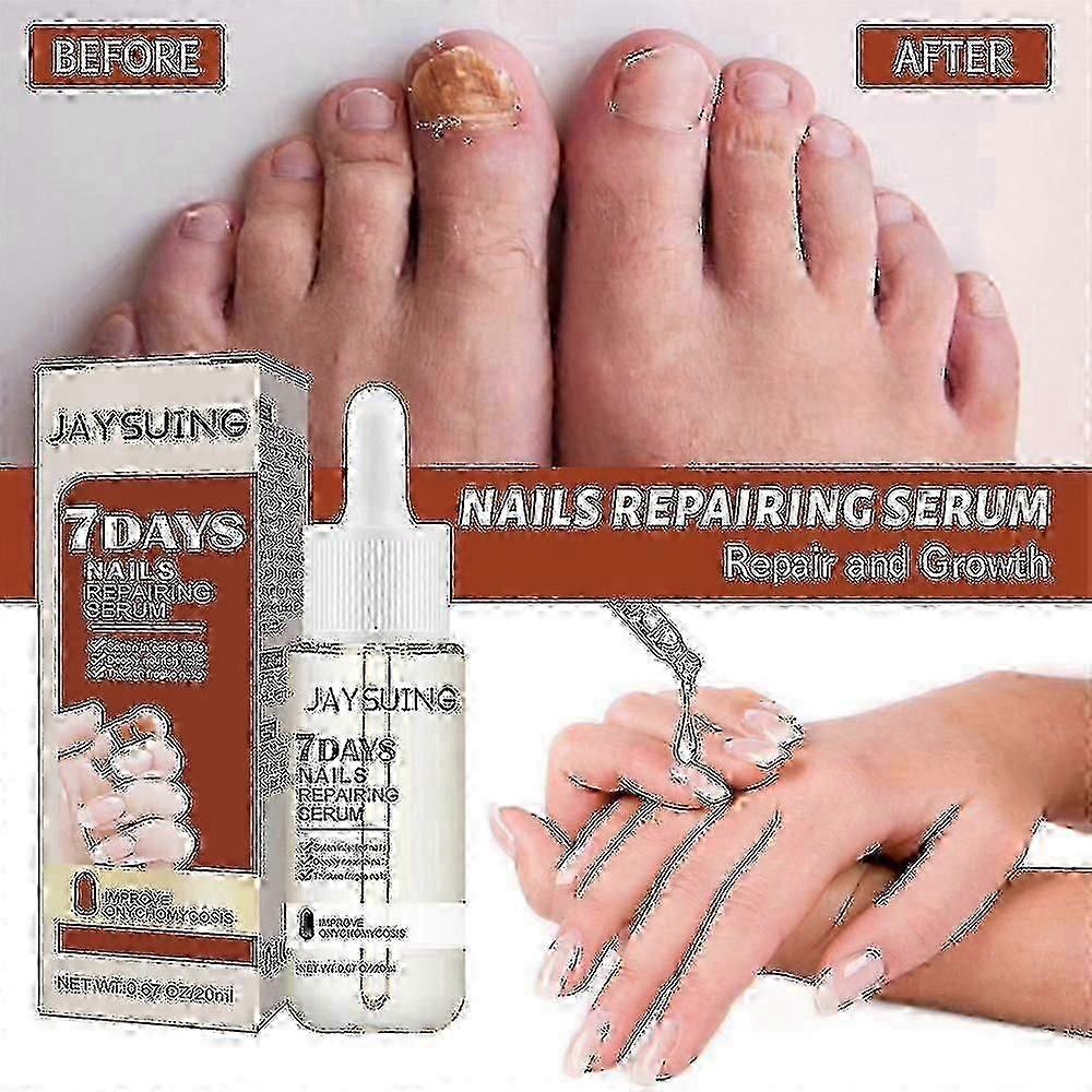 Jaysuing 7 Days Nail Repair Essence Element Repair Ingrown Nail Thickening Gray Nail Hand Foot Nail Repair Liquid