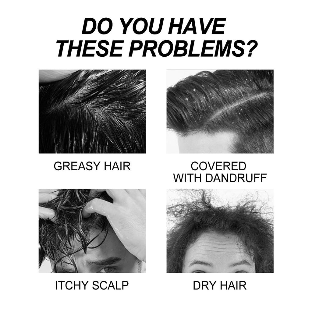 East Moon Men's Shampoo Deep Cleansing Nourishing Roots Anti Hair Loss Strengthening And Thickening Formula 100ml