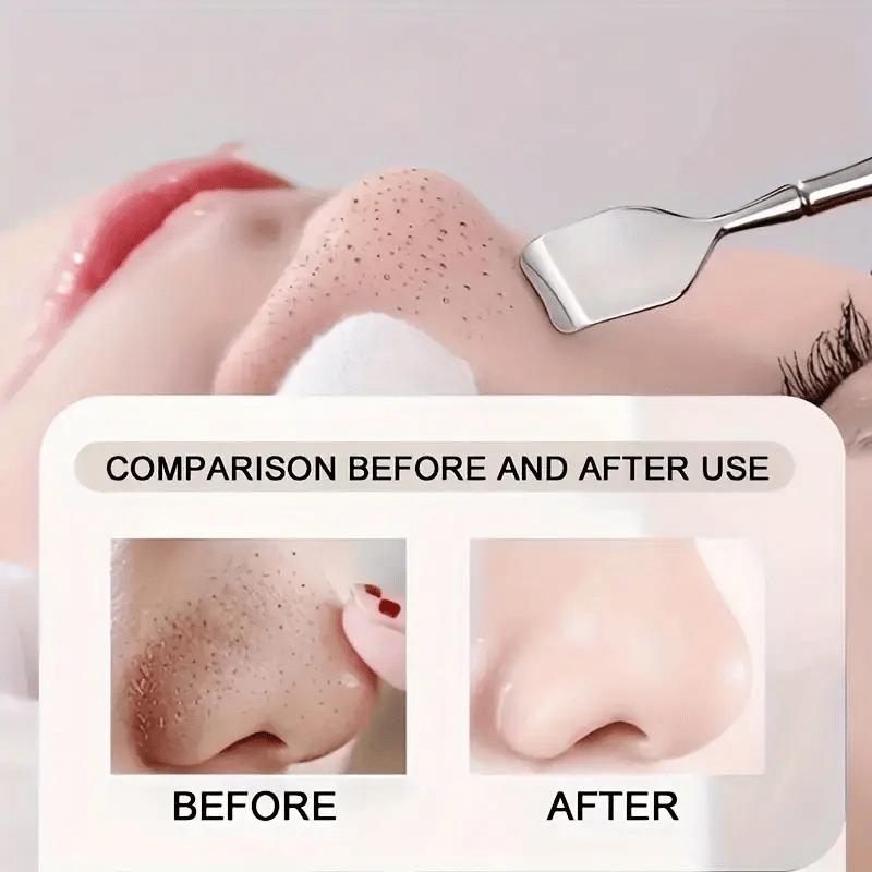 2-Piece Stainless Steel Facial Roller Massager / Blackhead Remover Set - Face and Neck Skincare Tools