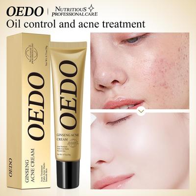 Mild Acne Cream - Clears Pores & Soothes Skin