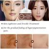 Women New Skin Brightening Cream&Freckle Cream&Dark Spot Corrector Remover for Face  Blemishes
