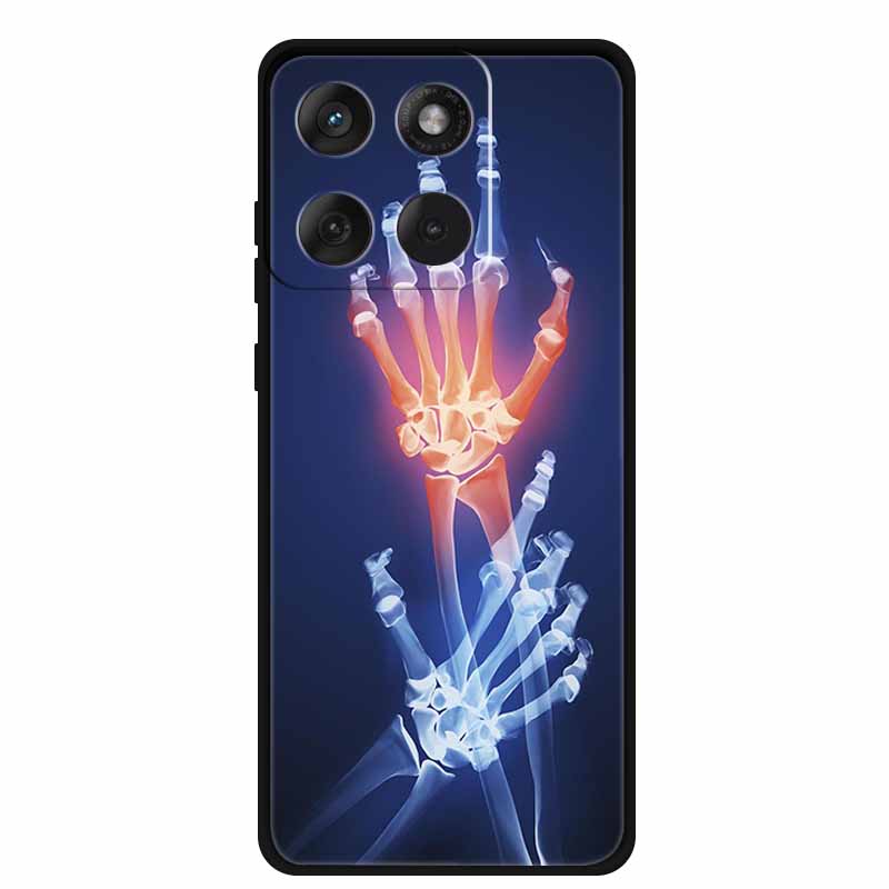 Für Motorola Edge 70 5G Hülle 2025 Mode Schwarz Silikon TPU Weiche Handyhülle Für Motorola Moto X70 Air 5G Rückseite Hülle Fundas