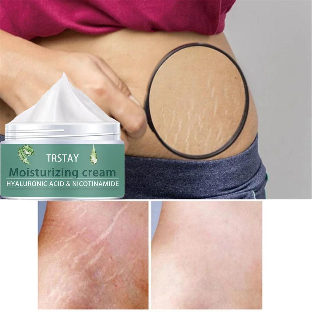 Pregnant Woman Stretch Mark Repair Cream Postpartum Repair and Fade Stretch Marks