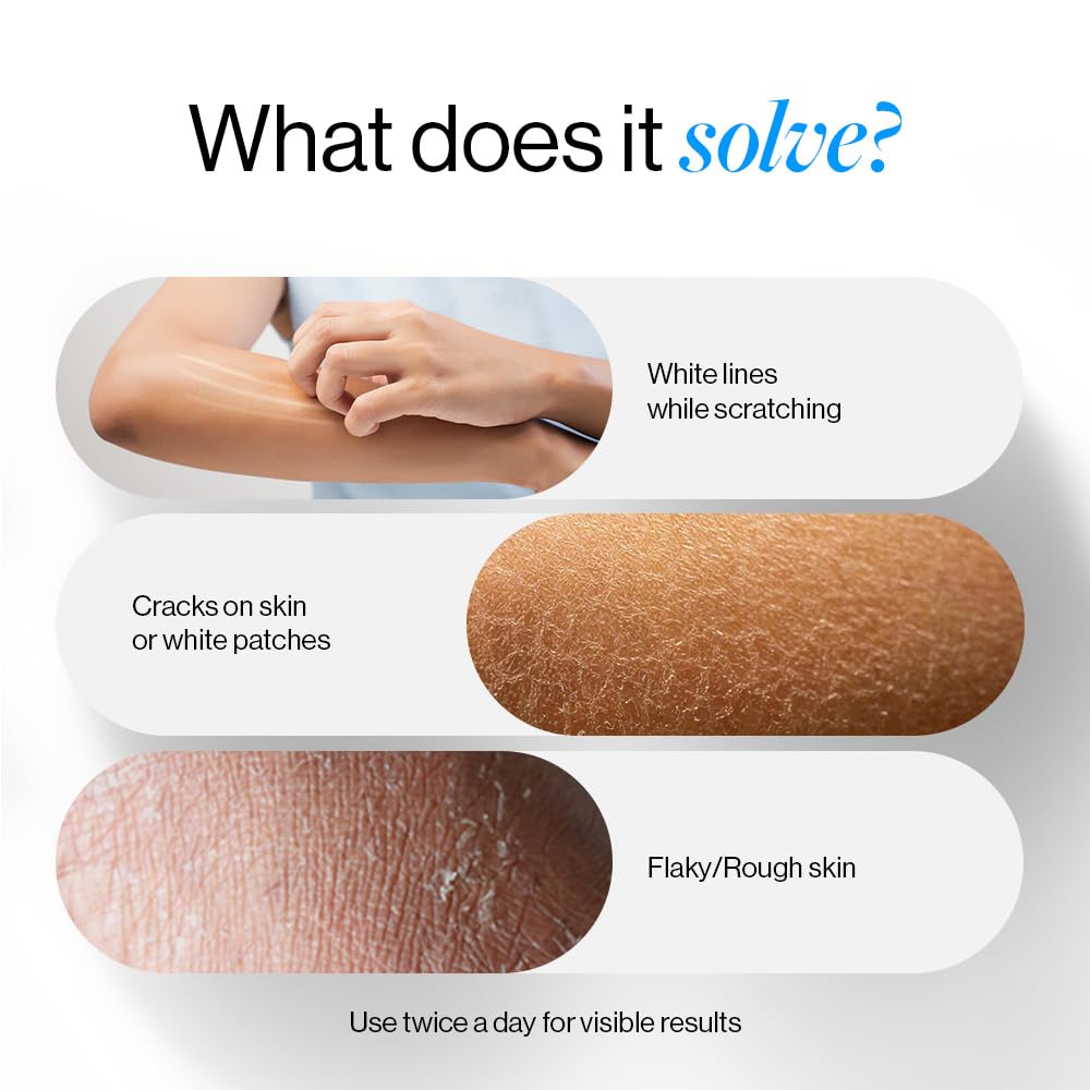 Be Bodywise 10% Urea Body Lotion 200ml | 48 Hour Dry Skin Relief | For Very Dry & Flaky Skin | With Ceramides, Kokum & Mango Seed Butter | Non-Greasy