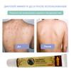 Caoshifu Natural Herbs Creams for Itch Solve Skin Problems 15g
