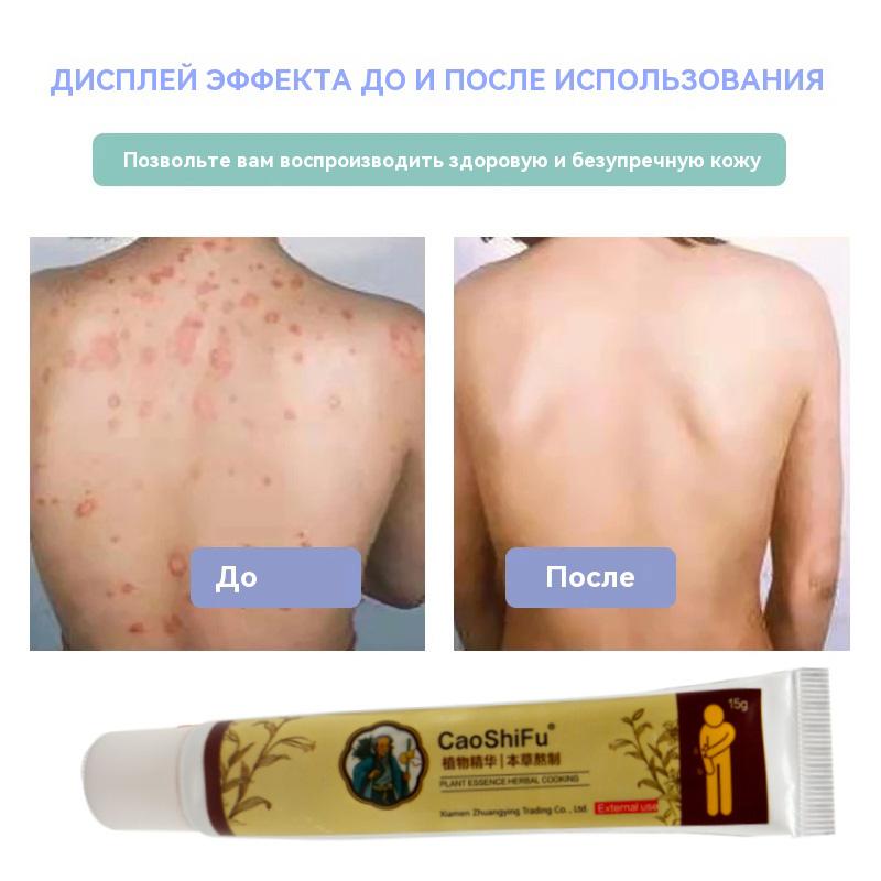 Caoshifu Natural Herbs Creams for Itch Solve Skin Problems 15g