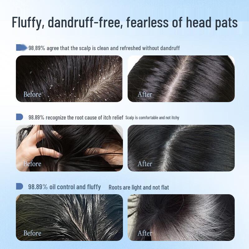 Three Magicians Selenium Disulfide Anti-Dandruff Shampoo