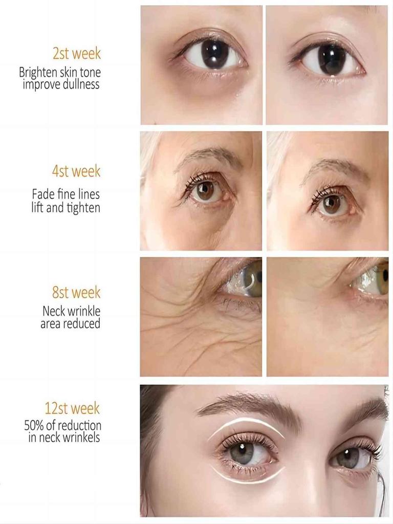 Moisturizing Eye Cream To Reduce Swelling, Mild and Non-irritating, Anti-skin Puffiness, Moisturizing, Anti-aging, Nourishing Skin