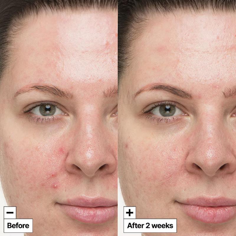 Dr.Jart Cicapair™ So Soothing Treatment 30mL (3 Options)