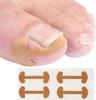 20-100pcs Adhesive Toenail Patch Ingrown Toe Nail Correction Sticker Foot Corrector Pedicure Health Care Tools Toe Treatment Pad