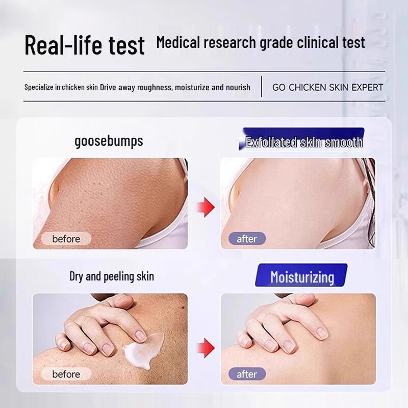 Behandlungskörperseife für Keratosis Pilaris