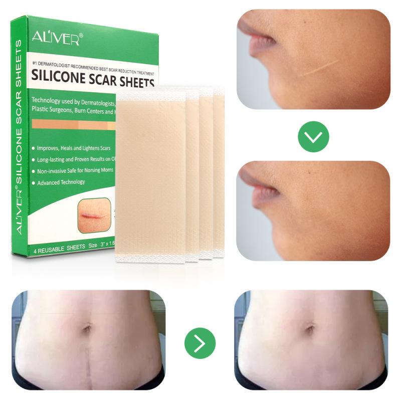 4 Sheets Scar Removal Patch Reusable Silicone Therapy Scar Repair Patch Long-lasting Sticker